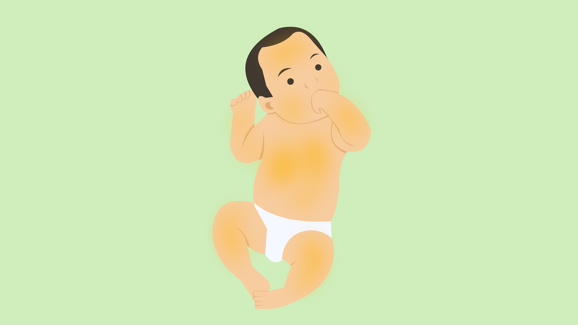 什么叫母乳性黄疸