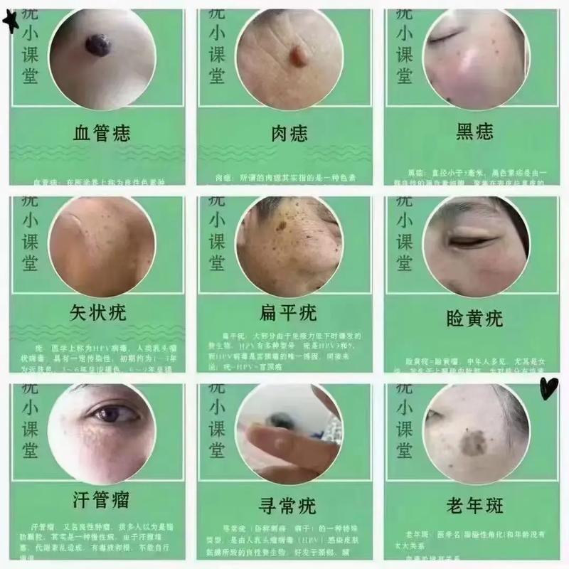20种皮肤病对照表 20种皮肤病对照表图片