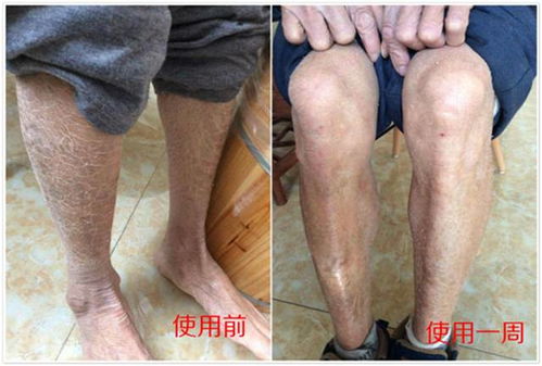 红脸怎么治 红脸怎么治