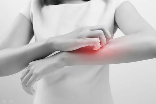 手淫导致痤疮 痤疮治疗存在五大误区 手淫导致痤疮 痤疮治疗存在五大误区