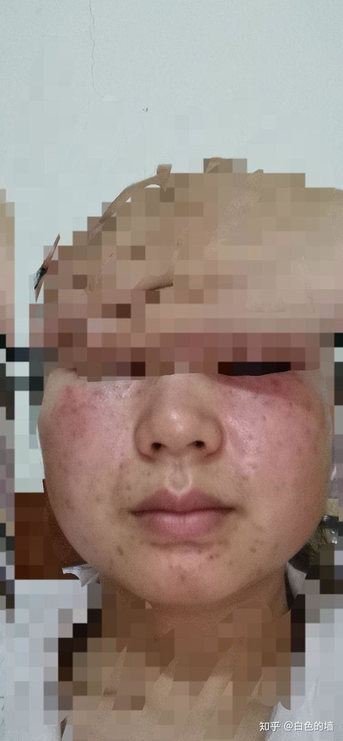 宝宝感冒咳嗽可以喝牛奶吗 宝宝感冒咳嗽可以喝牛奶吗