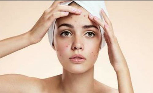 远离灰指甲的方法有哪些 远离灰指甲的方法有哪些