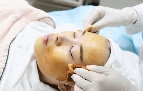 四个月婴儿37.5度算发烧吗 四个月婴儿37.5度算发烧吗