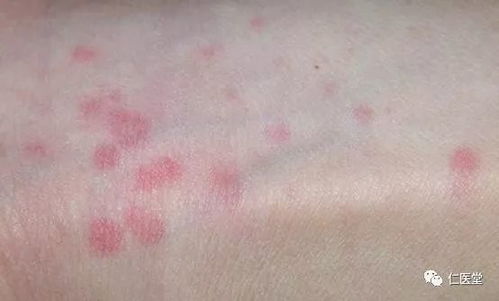 什么是法洛四联症 什么是法洛四联症