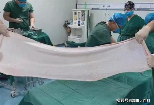 两个月宝宝睡觉头转来转去是什么原因 两个月宝宝睡觉头转来转去是什么原因