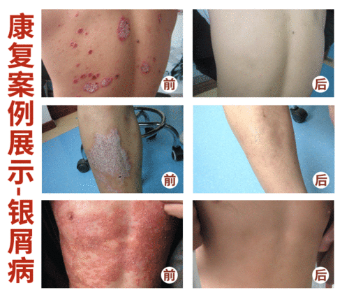 ȱˮ�����ԭ����