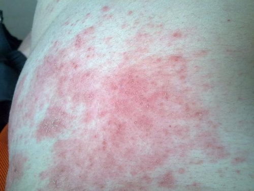 睡醒后小腿酸痛是怎么回事 睡醒后小腿酸痛是怎么回事