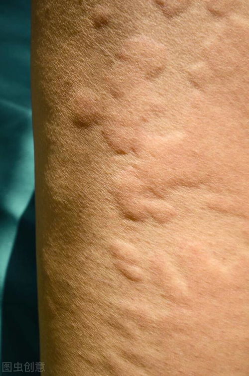 ������ˮϴϴ�� Ԥ���������