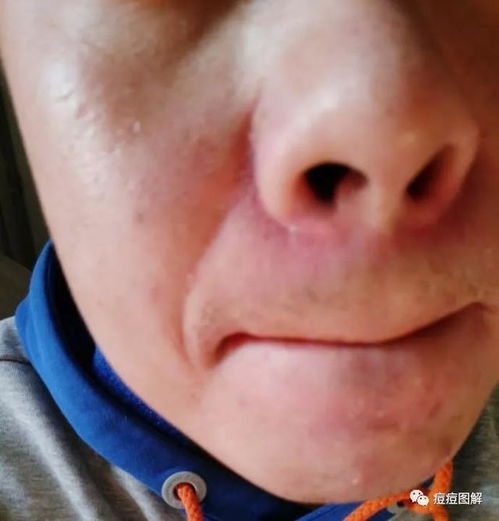 �Ժ���������Ԥ���