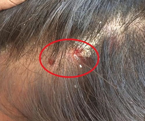 ü�ĳ����ô����