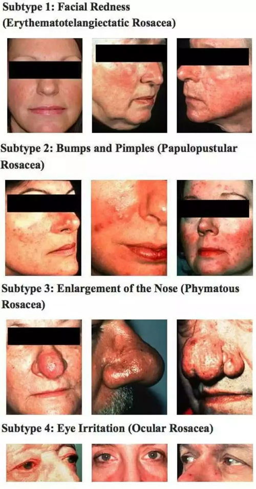 �յ����쳧 �յ����쳧�л�ѧרҵ����