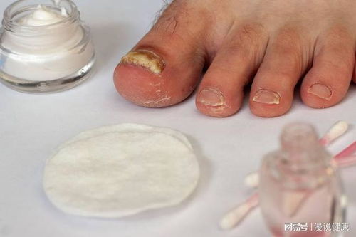 �������ʳԭ������Щ