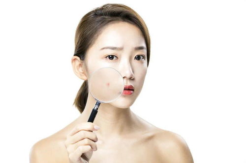 五种缓解荨麻疹病情的方法 五种缓解荨麻疹病情的方法