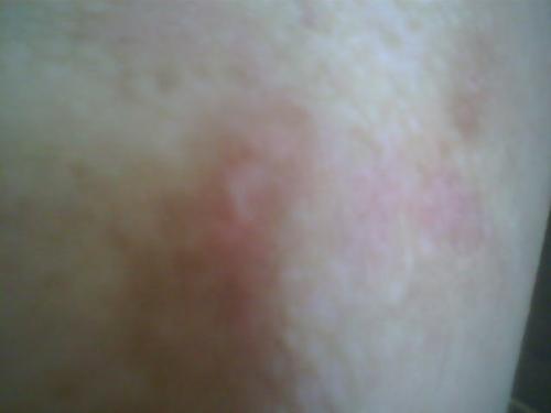 �ഺ�ڳ���Ϫ�����ר��ҽԺ