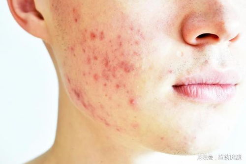 �����Щ����ԭ��