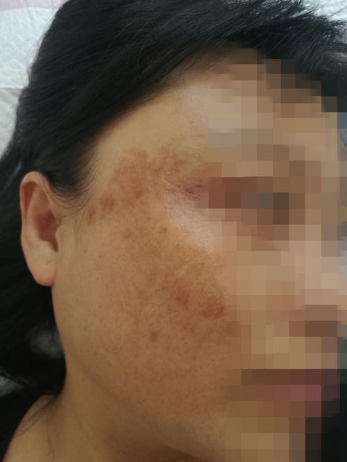 ������������ָ�� �����ȷϴ�� 