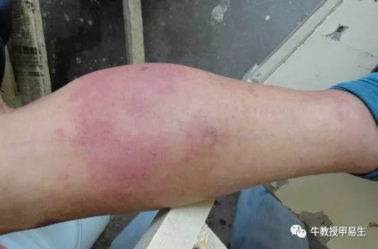 ճʪƤǻ ʪ߾ӼһҪ1 ʪƤճֲ ʪ滺ָ1