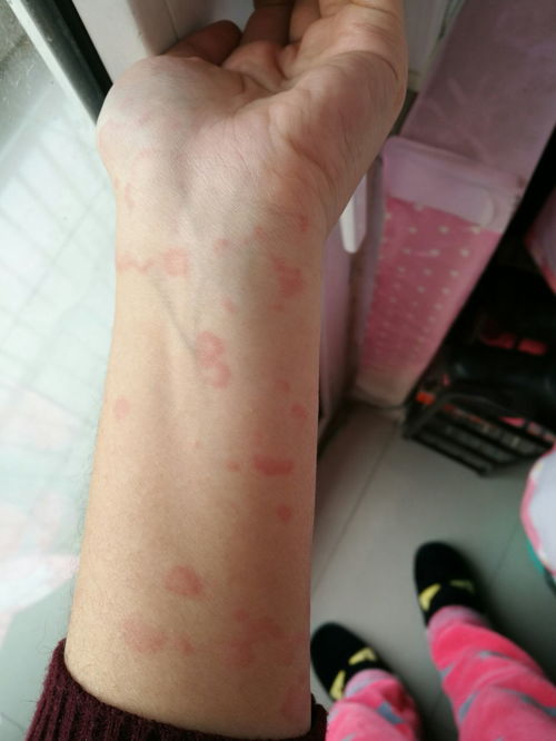 �沿����׵�ԭ������Щ