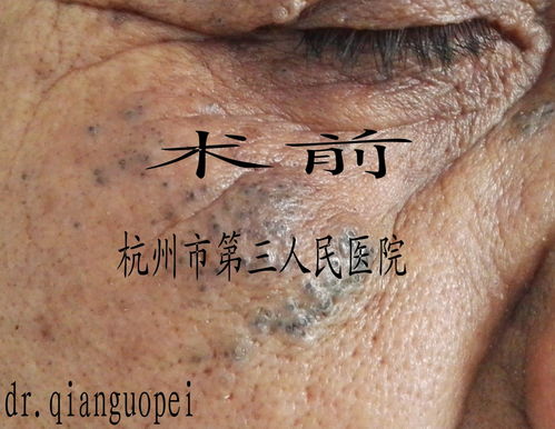 �ۺ������ô�� �ճ�����Ҫ