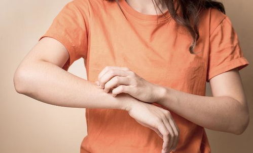 肛周湿疹症状表现 瘙痒红肿皮肤病变等特征 肛周湿疹症状表现 瘙痒红肿皮肤病变等特征