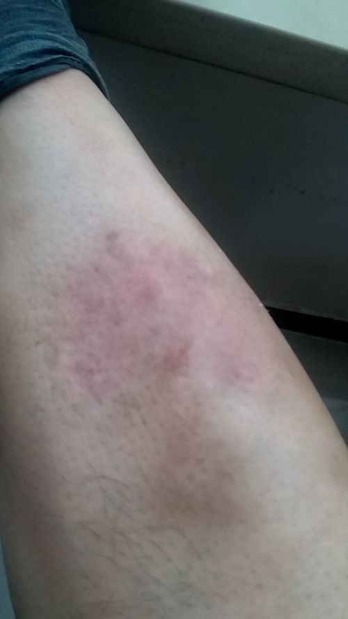 ��ָ�׳�ʶ����Щ