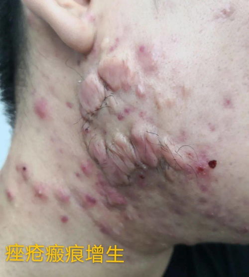 ۶ʮһźԱ齫ڽʵʩһγջ