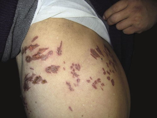 ���������ƻ�ָ�׵�ҽԺ