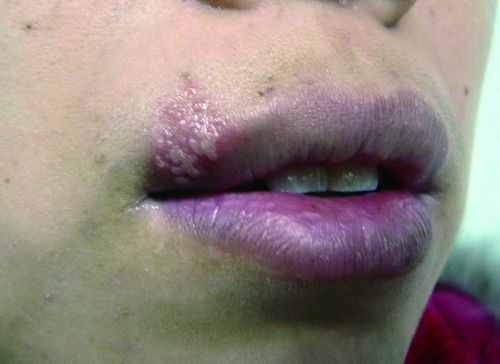 冬天常穿高筒皮靴易脚气 冬天常穿高筒皮靴易脚气