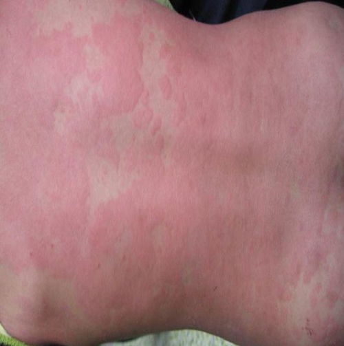 ��ָ�׵�ԭ�������� 