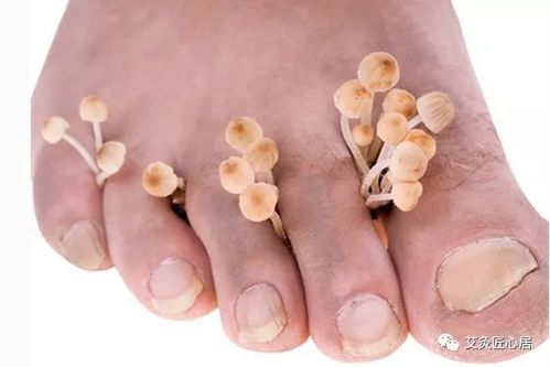 ���ƻ�ָ����ʲôҩ����Ч����