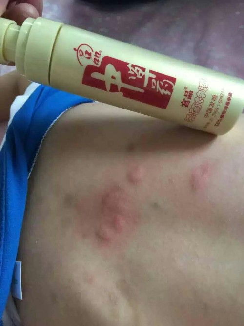 ��ָ�׵�Ԥ�������