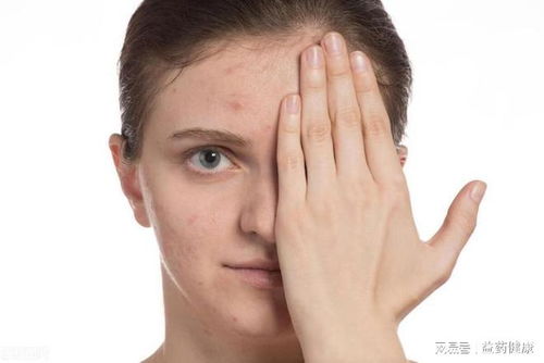 灰指甲的一些辨别的方法 灰指甲的一些辨别的方法