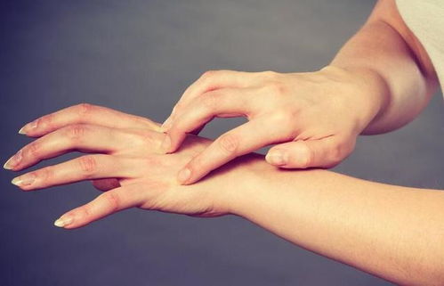 石家庄治疗牛皮癣安全的 吃治牛皮癣的中药更严重是正常的吗 石家庄治疗牛皮癣安全的 吃治牛皮癣的中药更严重是正常的吗