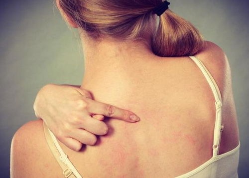 ������ָ��ȥ�ĸ�ҽԺ�� ��ָ��Ѣ�ķ���ԭ������Щ