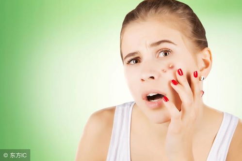 远离荨麻疹 切断传播途径为首要 远离荨麻疹 切断传播途径为首要