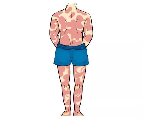 早上醒来痰多怎么回事 早上醒来痰多怎么回事