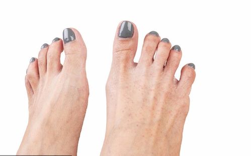 ��μ����ָ�����س̶� ��ָ���Ƿ�����