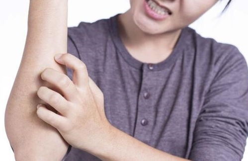 内分泌失调导致的痤疮怎么办 内分泌失调导致的痤疮怎么办