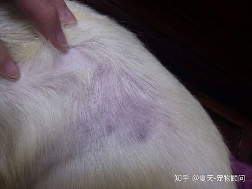 牛皮癣到底能否有效的治疗 牛皮癣到底能否有效的治疗