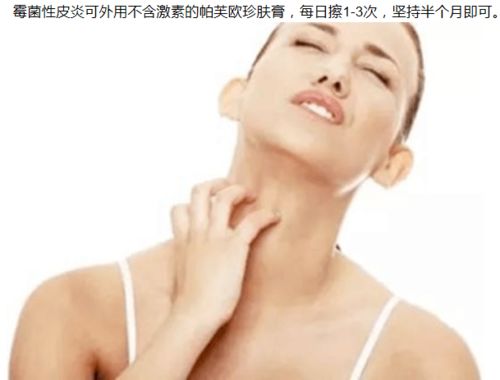 绿豆水治疗牛皮癣的事项有哪些 绿豆水治疗牛皮癣的事项有哪些