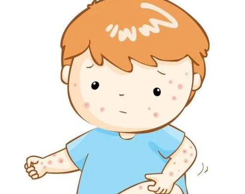 日常该怎样来护理灰指甲 日常该怎样来护理灰指甲