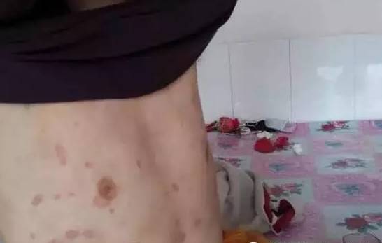 上颚靠近门牙肿痛是怎么回事 上颚靠近门牙肿痛是怎么回事