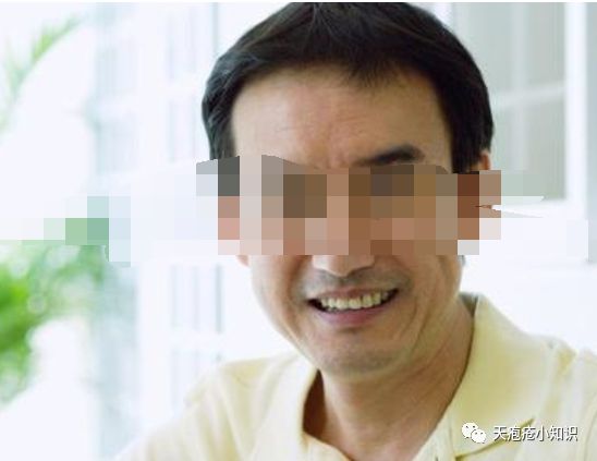 疱疹病毒是什么症状 疱疹病毒是什么症状