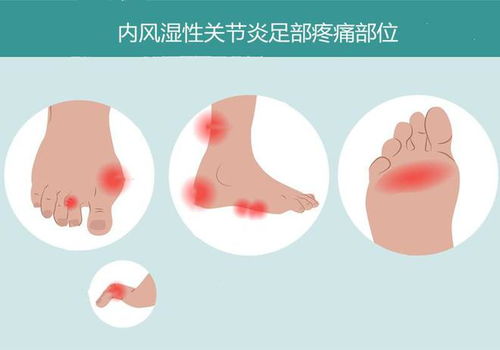 �ļ��Ļ�ָ��Ԥ����Ⱦ��