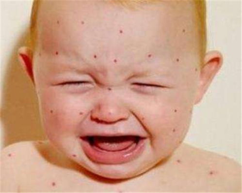 灰指甲的日常护理事项 灰指甲的日常护理事项