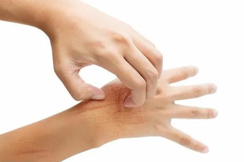 颞下颌关节功能紊乱症如何治疗 颞下颌关节功能紊乱症如何治疗