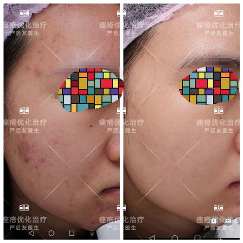 ݡ������ճ�Ҫע����Щ���� 