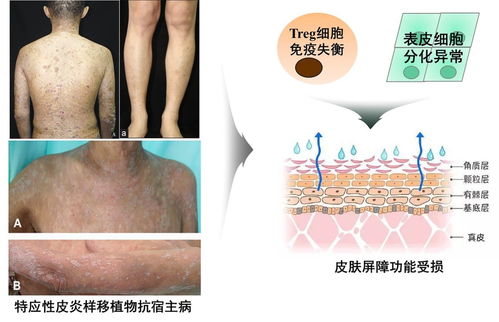 灰指甲疾病的症状有哪些 灰指甲的四大症状表现 灰指甲疾病的症状有哪些 灰指甲的四大症状表现