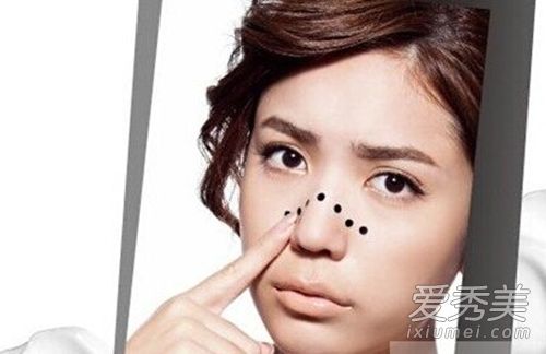 荨麻疹危害 荨麻疹危害