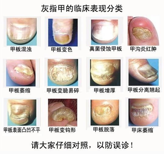 ݡ�����ճ�Ҫ�����ʳ